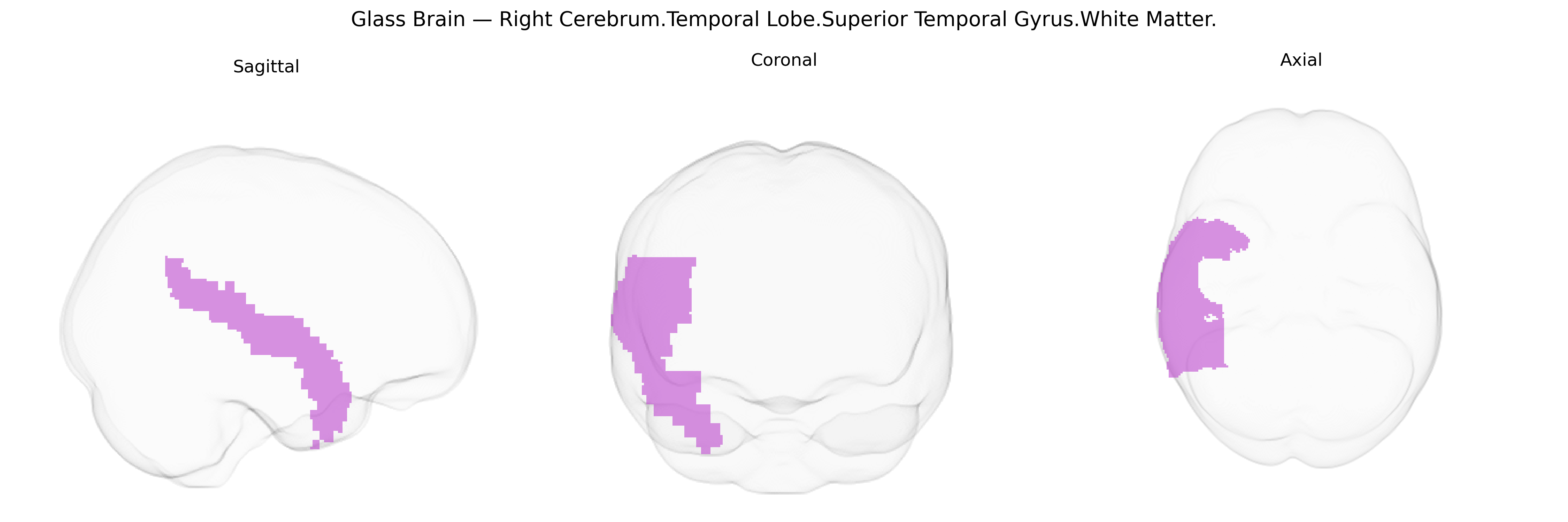 Triplanar Ghost Brain