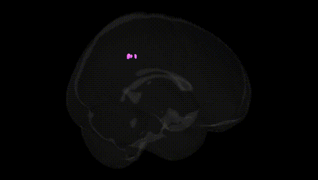 Full Brain Black