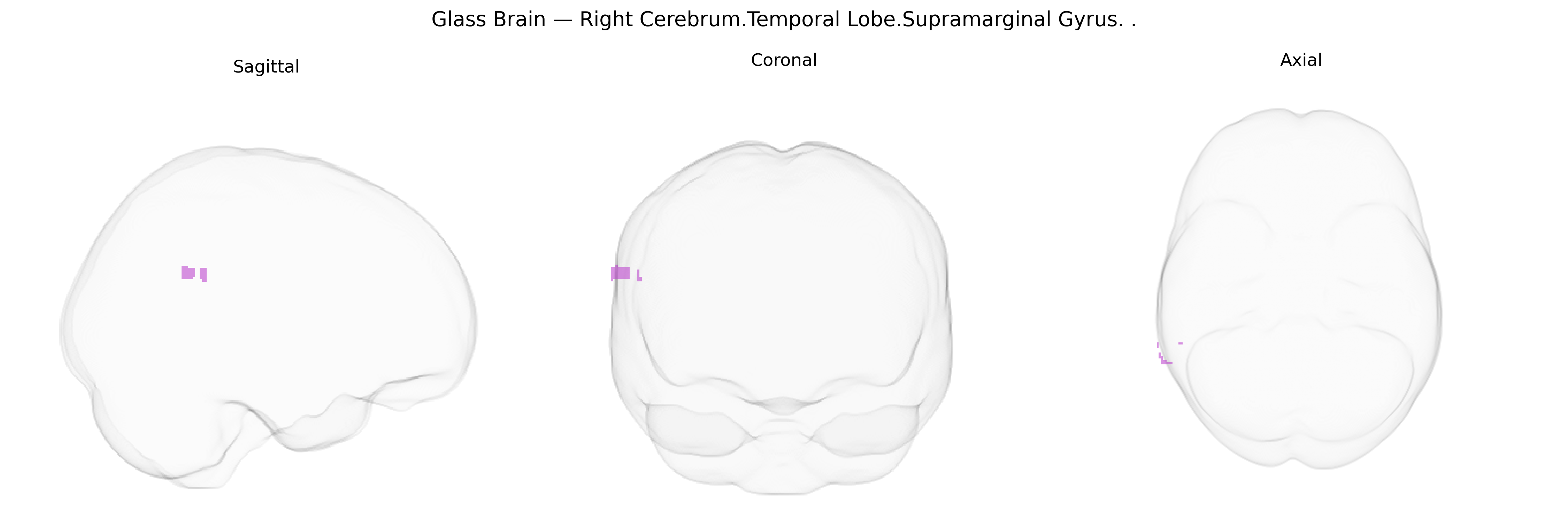 Triplanar Ghost Brain