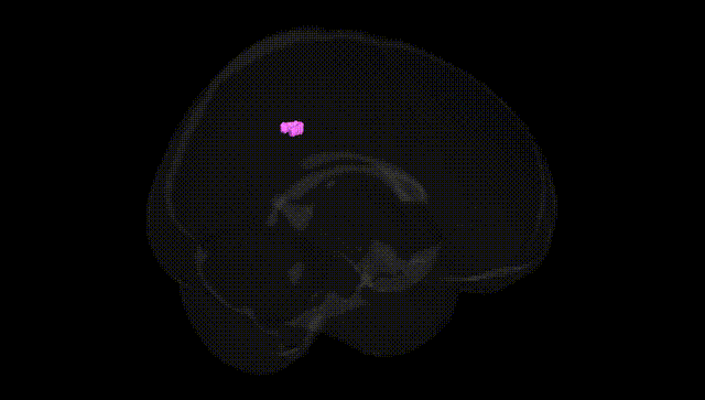 Full Brain Black