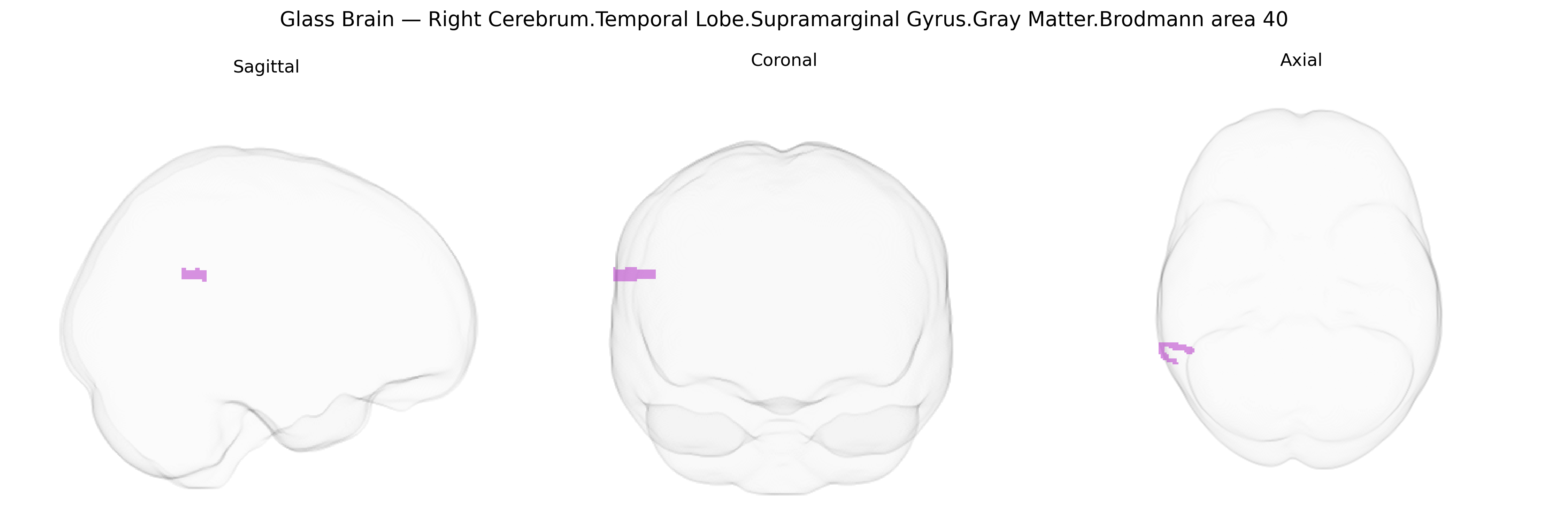 Triplanar Ghost Brain