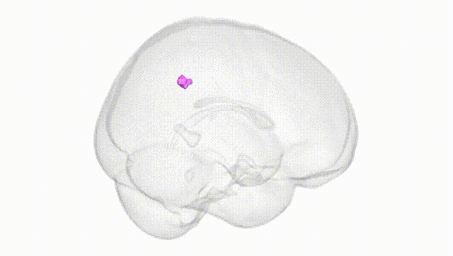 Full Brain White