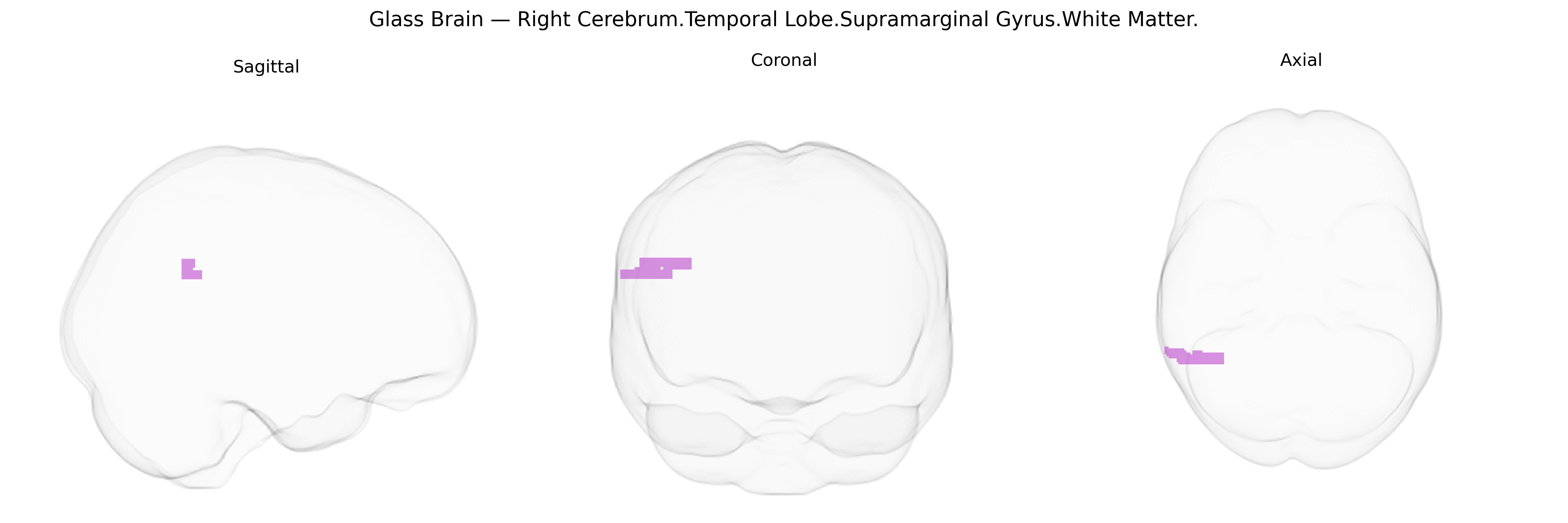 Triplanar Ghost Brain