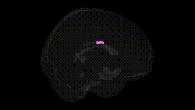 Full Brain Black