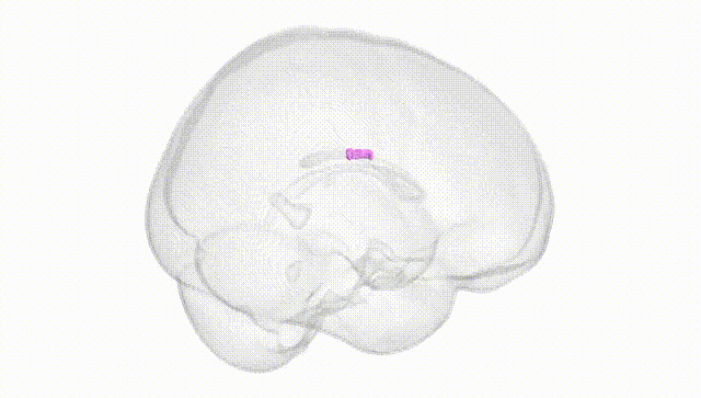Full Brain White
