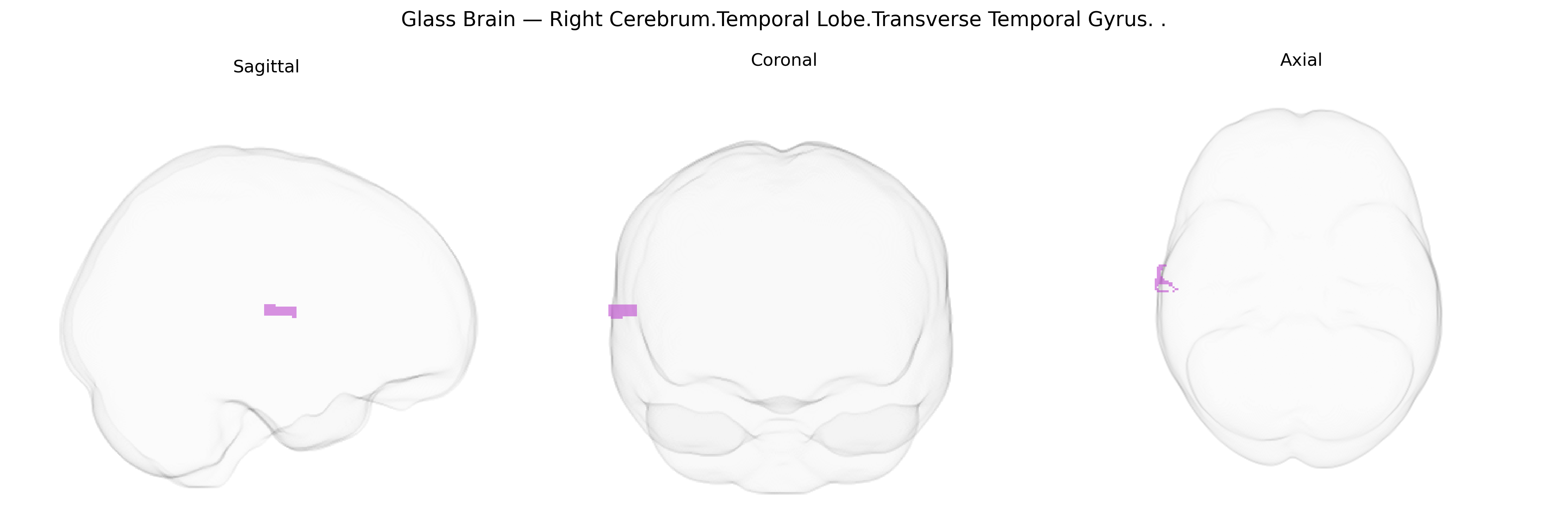 Triplanar Ghost Brain