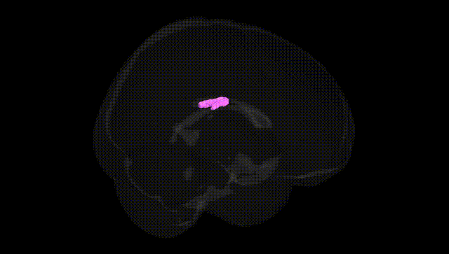 Full Brain Black