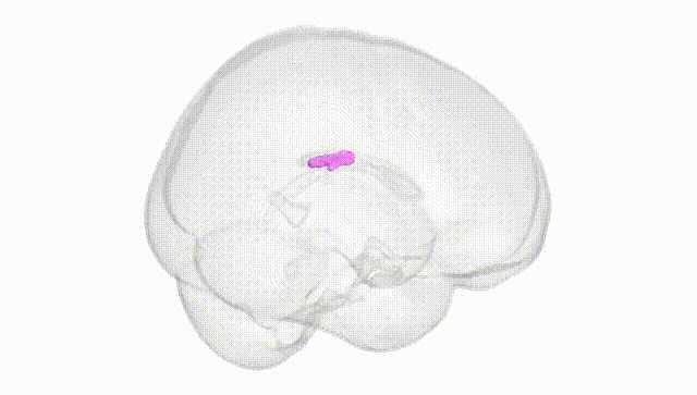 Full Brain White