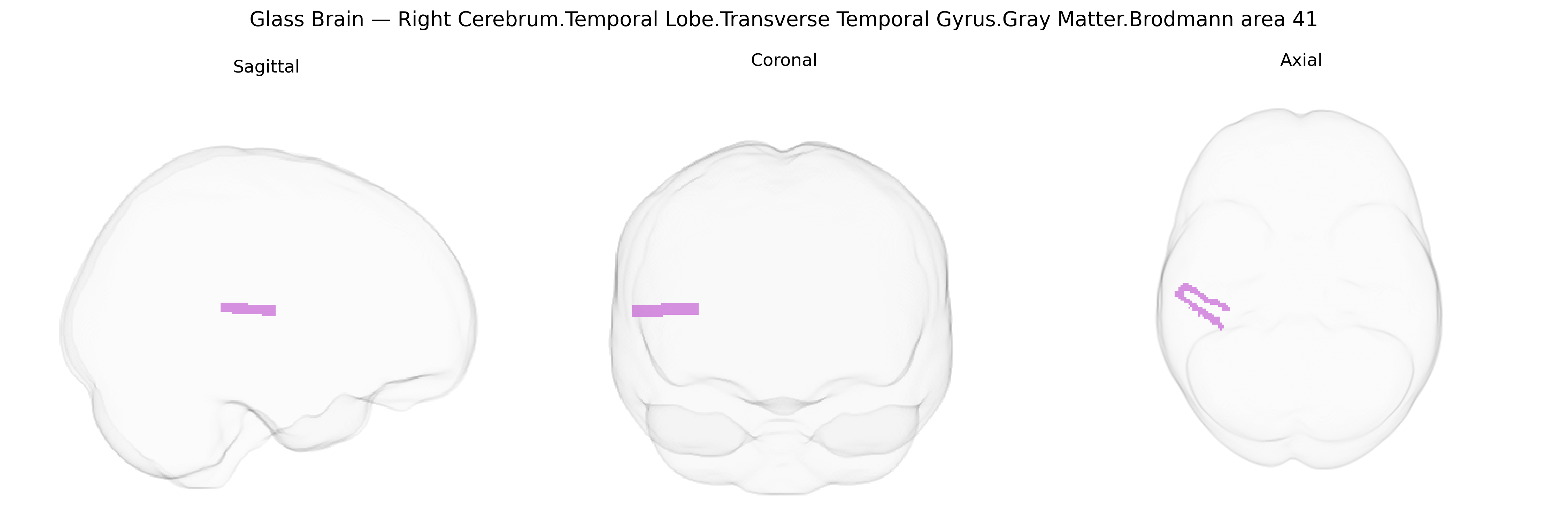 Triplanar Ghost Brain