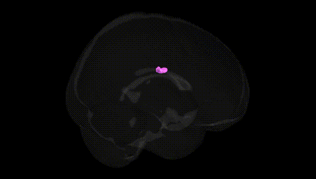 Full Brain Black