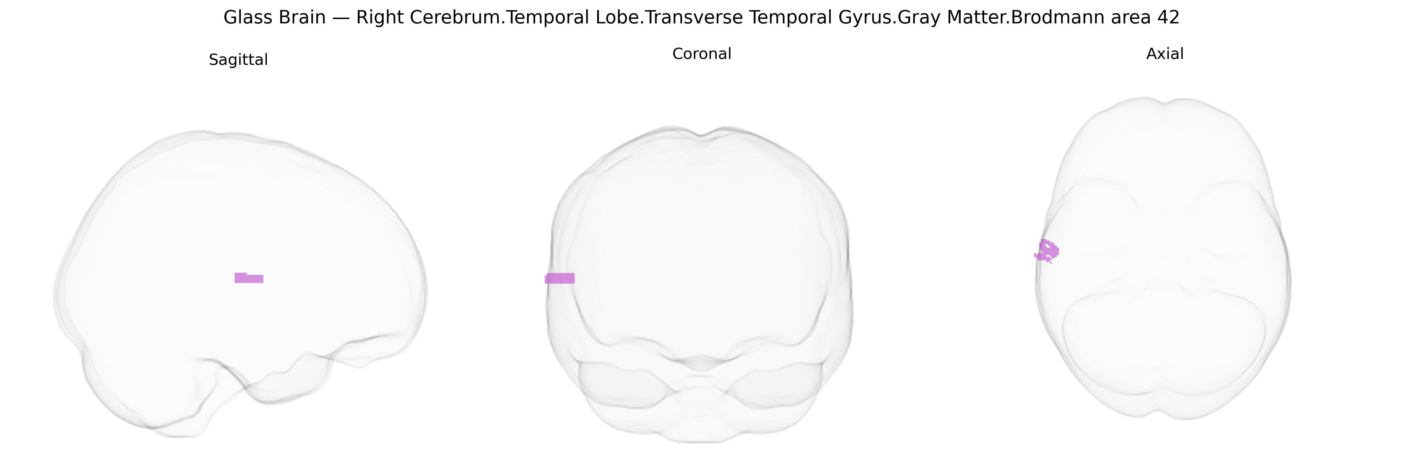 Triplanar Ghost Brain