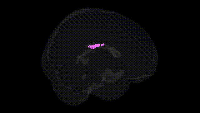 Full Brain Black