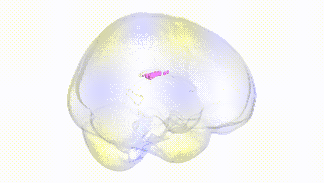 Full Brain White