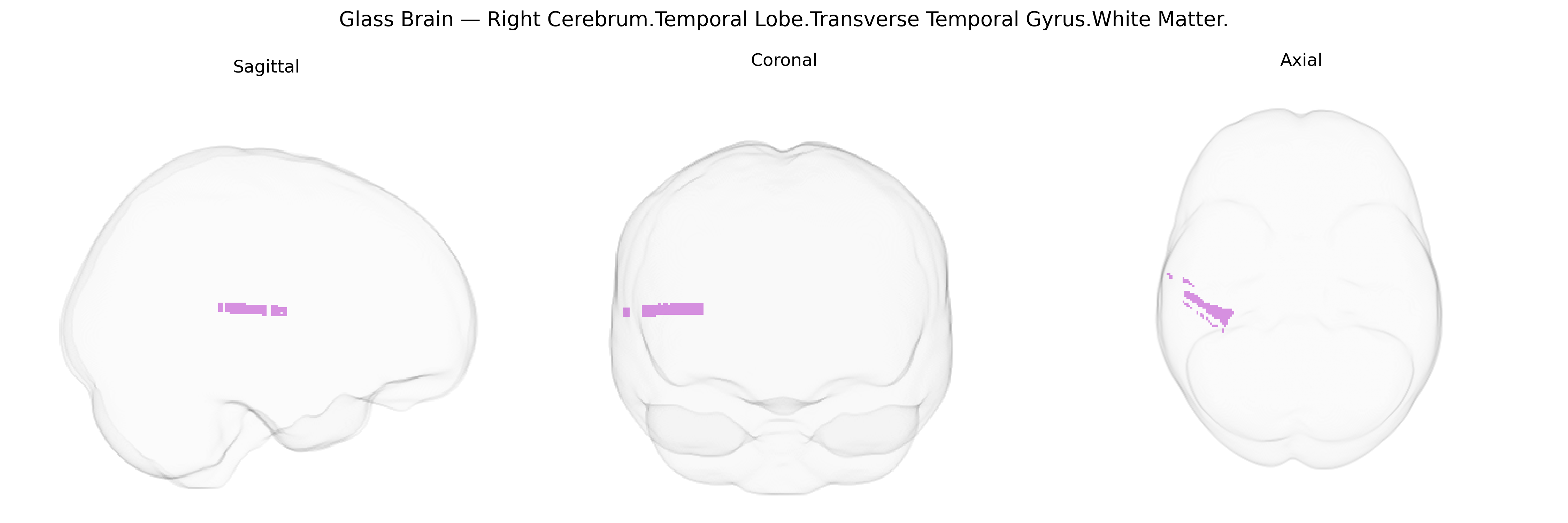 Triplanar Ghost Brain
