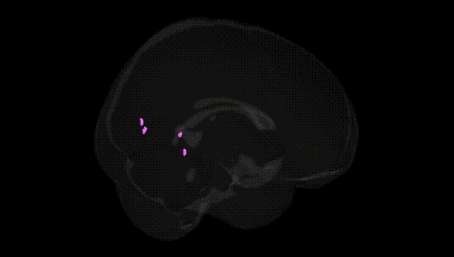 Full Brain Black