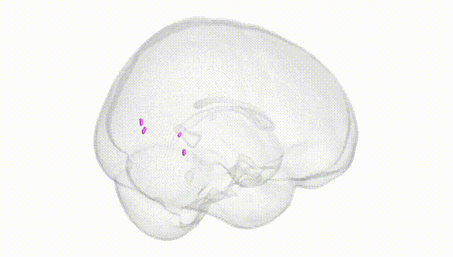 Full Brain White