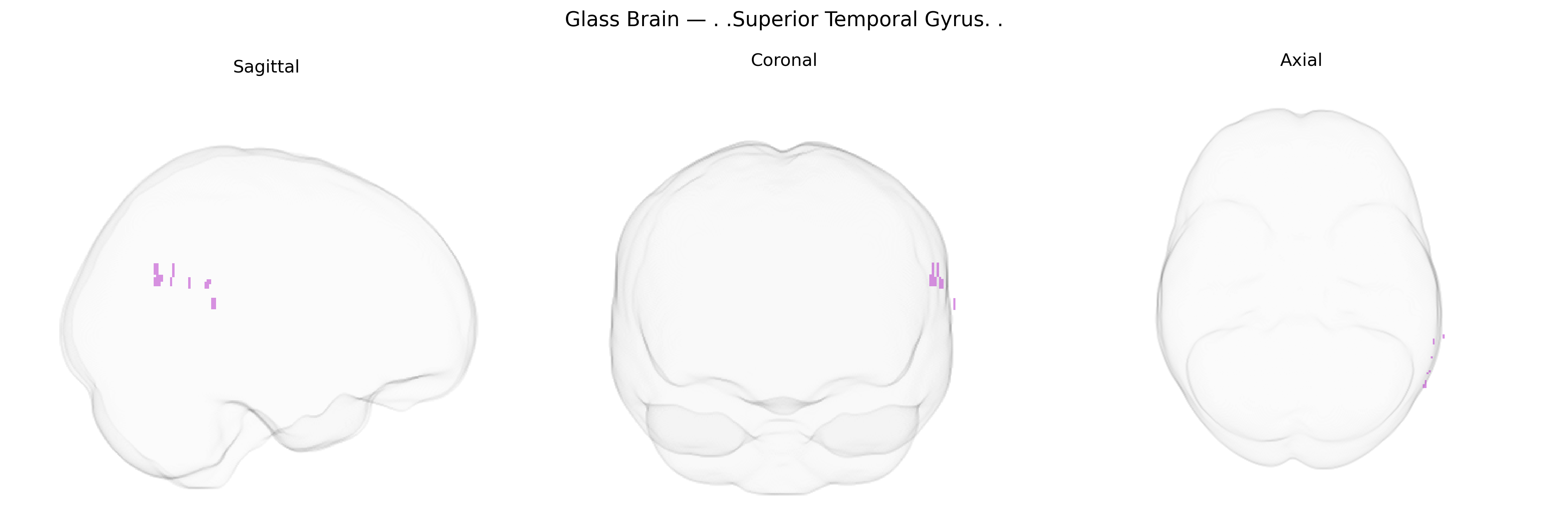 Triplanar Ghost Brain