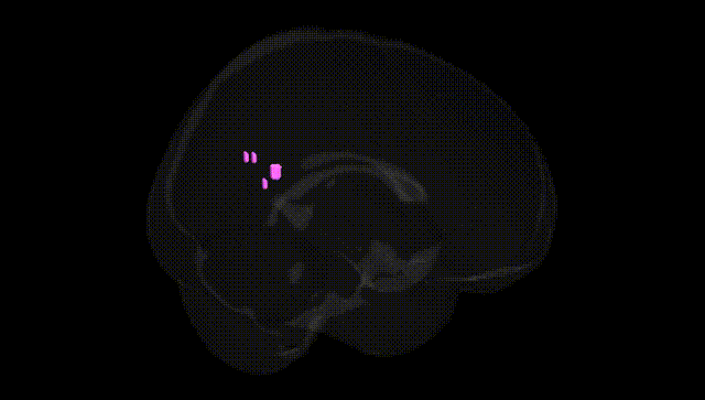 Full Brain Black