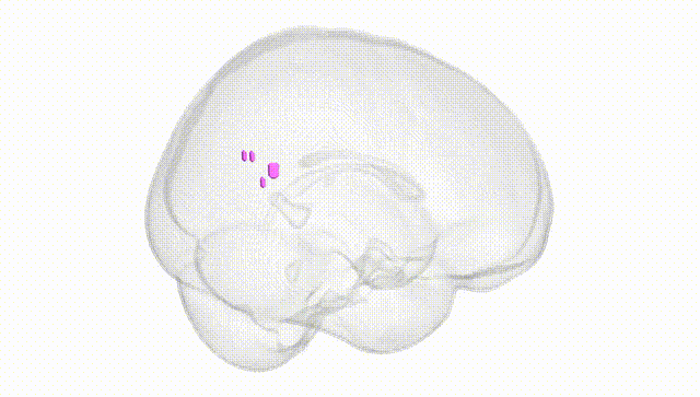 Full Brain White