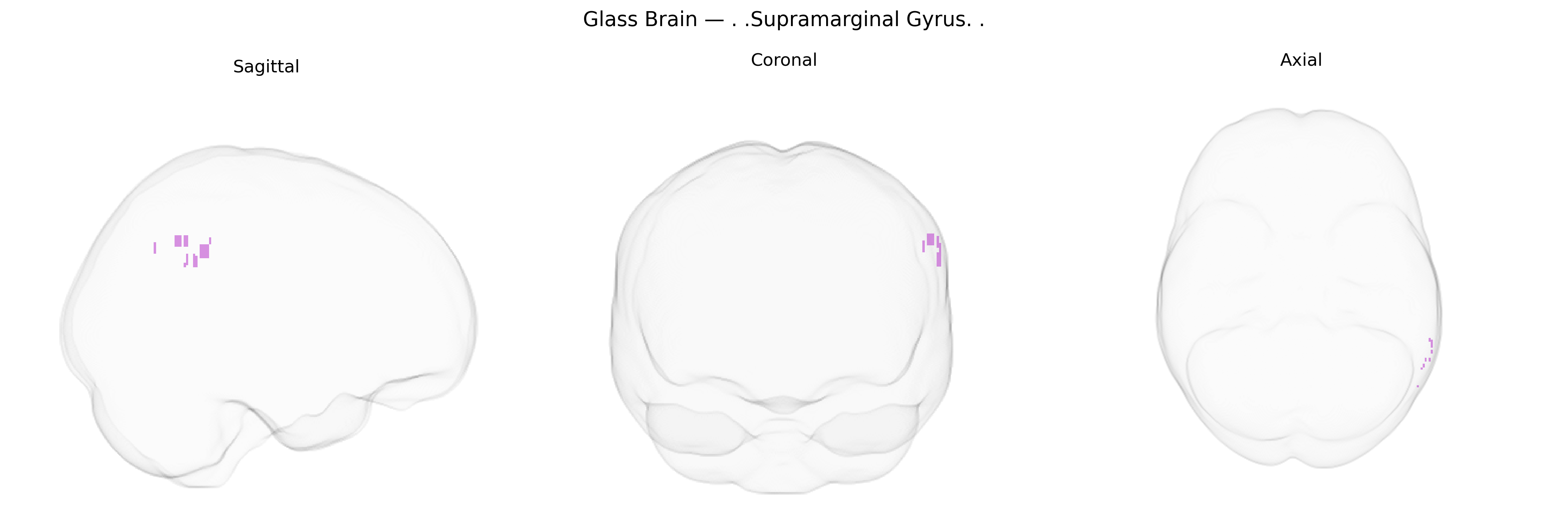Triplanar Ghost Brain