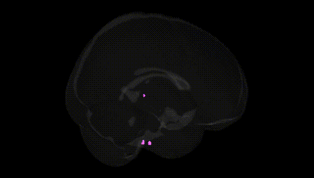 Full Brain Black
