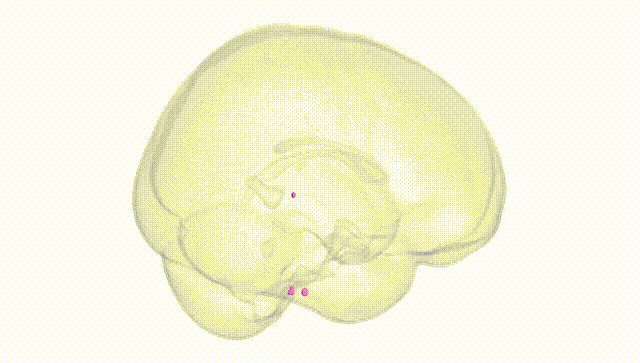 Full Brain White