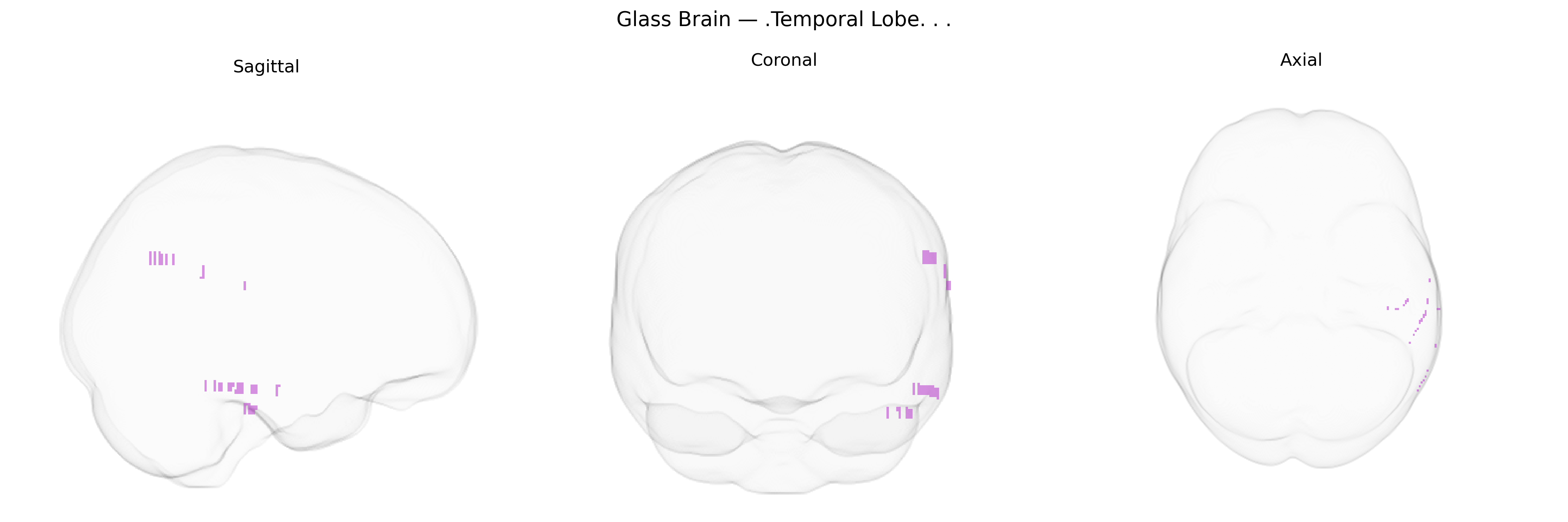 Triplanar Ghost Brain