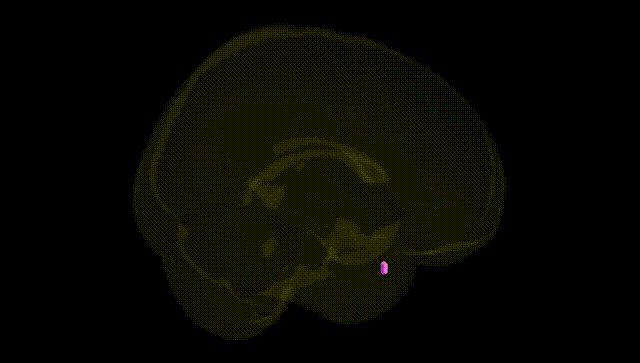 Full Brain Black