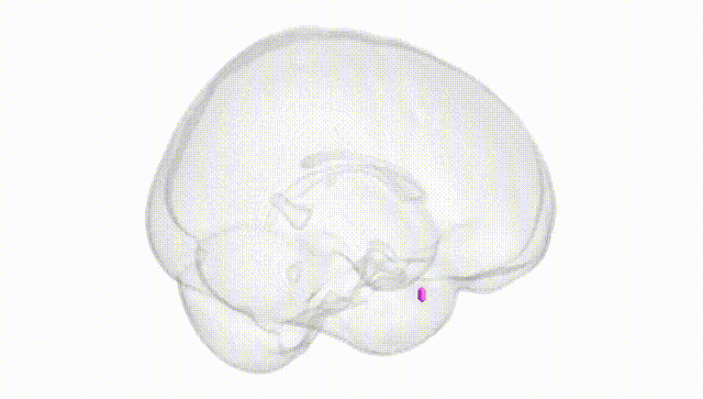 Full Brain White