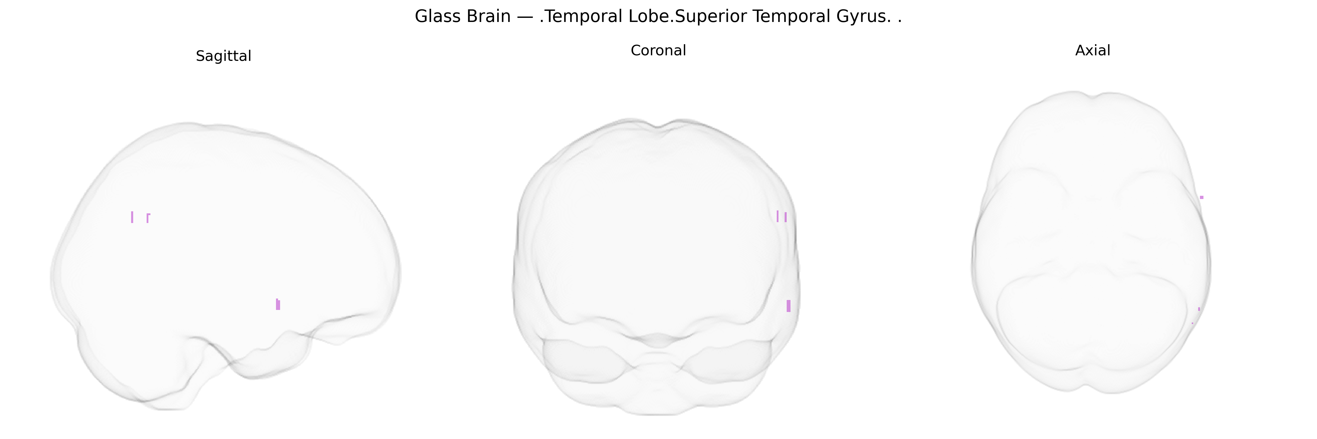 Triplanar Ghost Brain