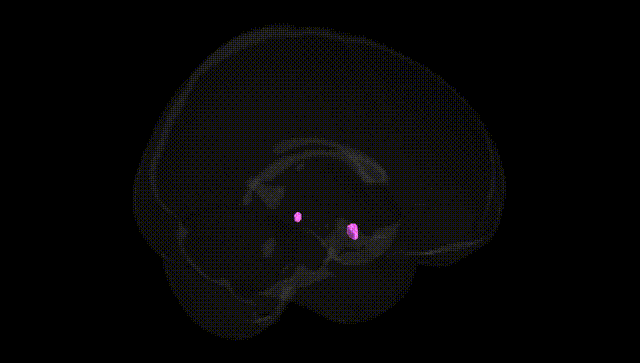 Full Brain Black