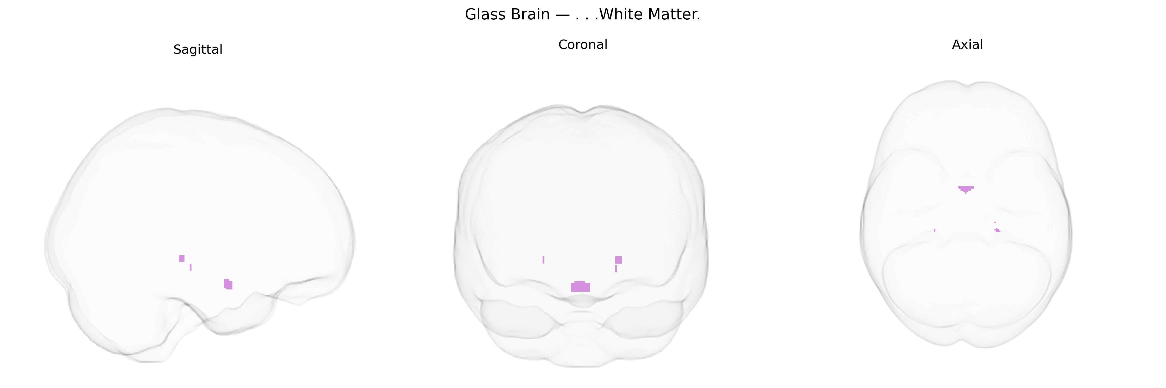 Triplanar Ghost Brain