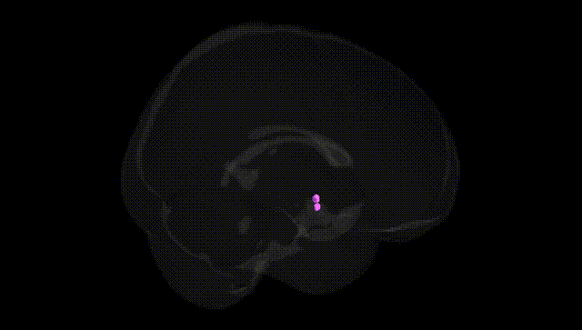 Full Brain Black