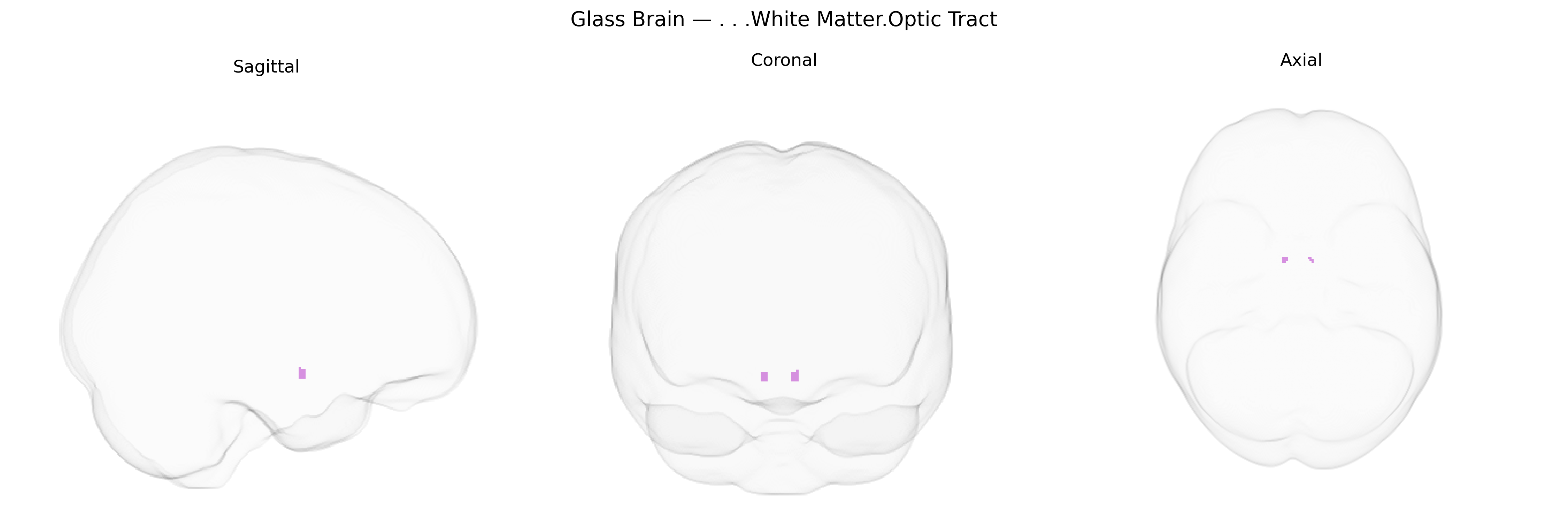Triplanar Ghost Brain