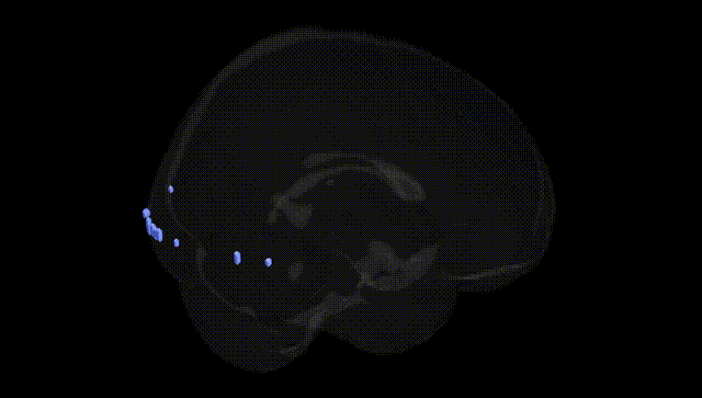 Full Brain Black