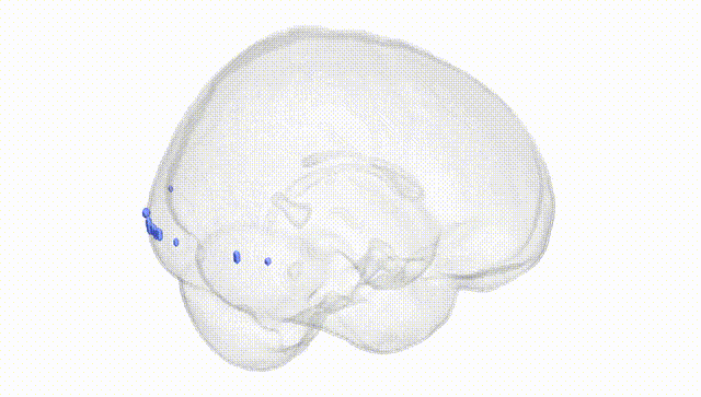 Full Brain White