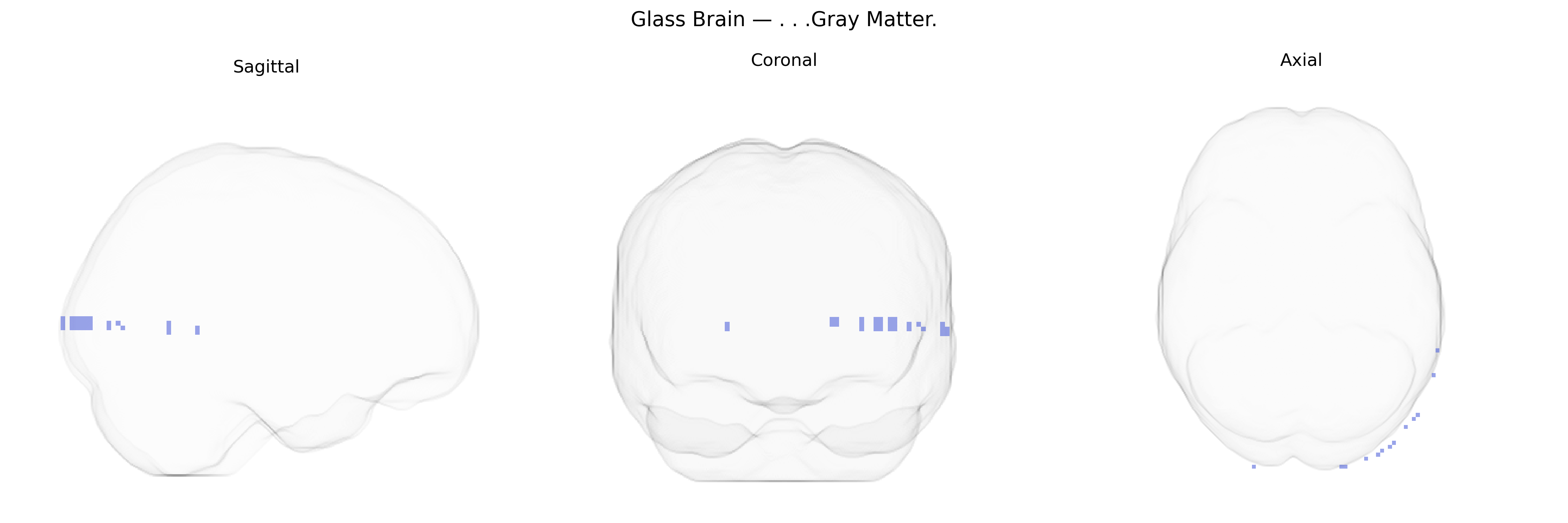 Triplanar Ghost Brain