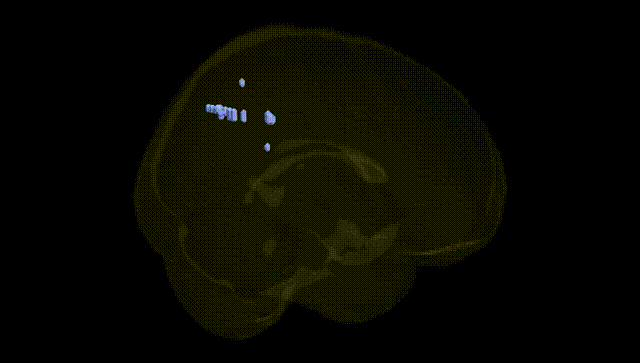 Full Brain Black