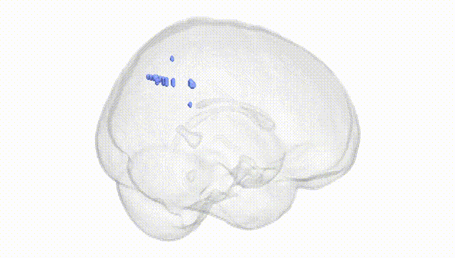 Full Brain White