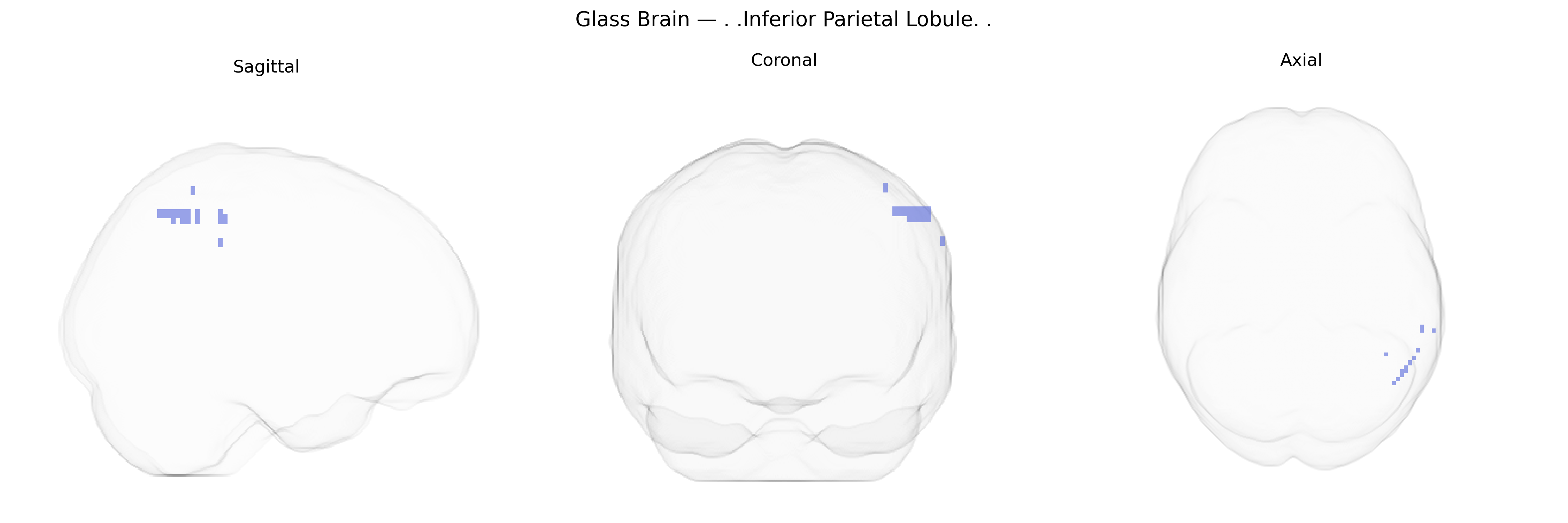 Triplanar Ghost Brain