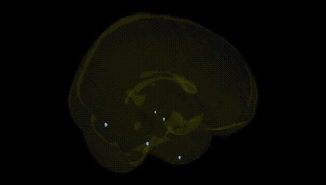 Full Brain Black