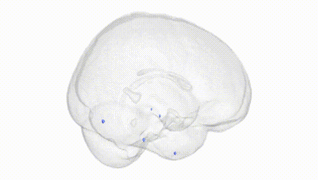 Full Brain White