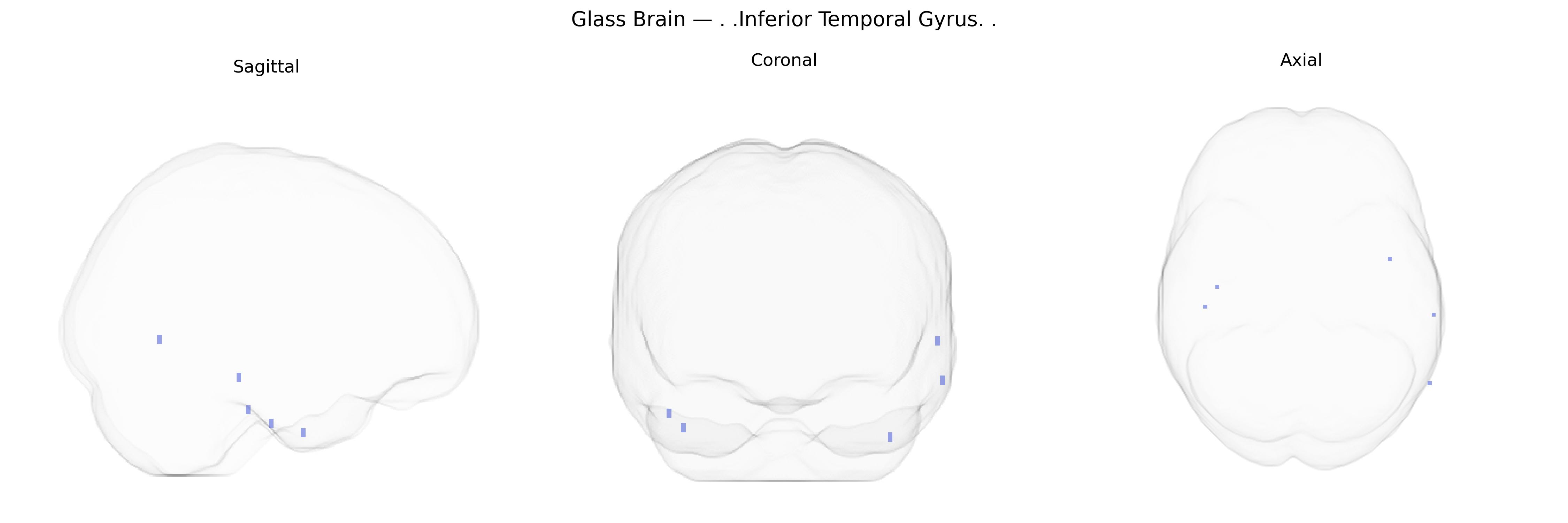 Triplanar Ghost Brain