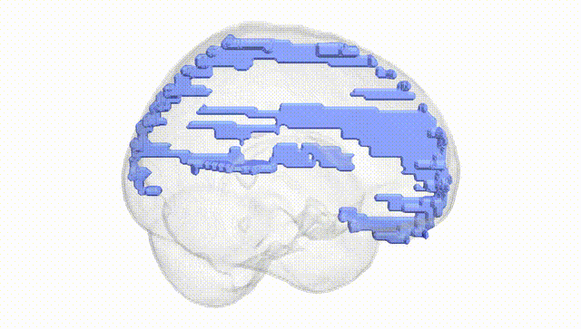 Full Brain White