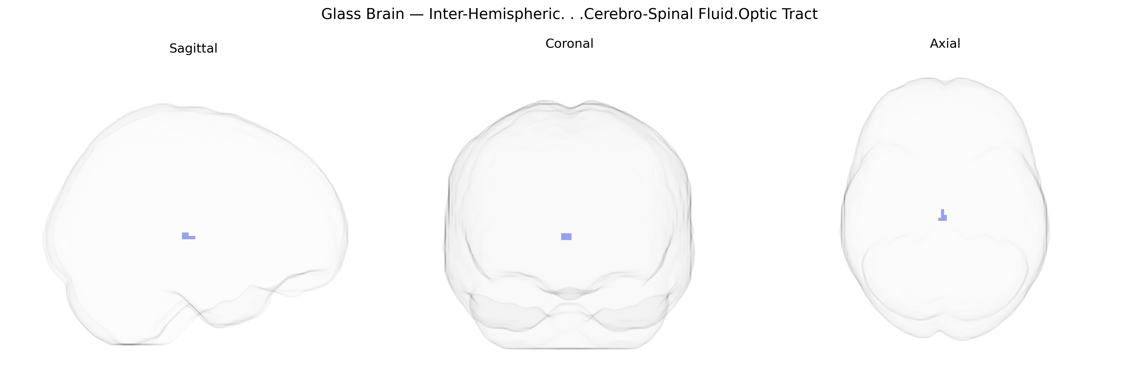 Triplanar Ghost Brain