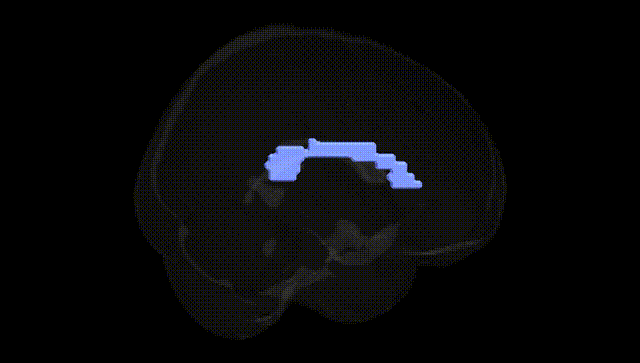 Full Brain Black