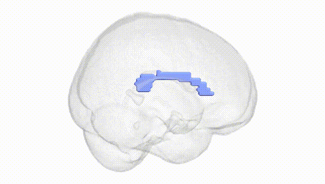 Full Brain White