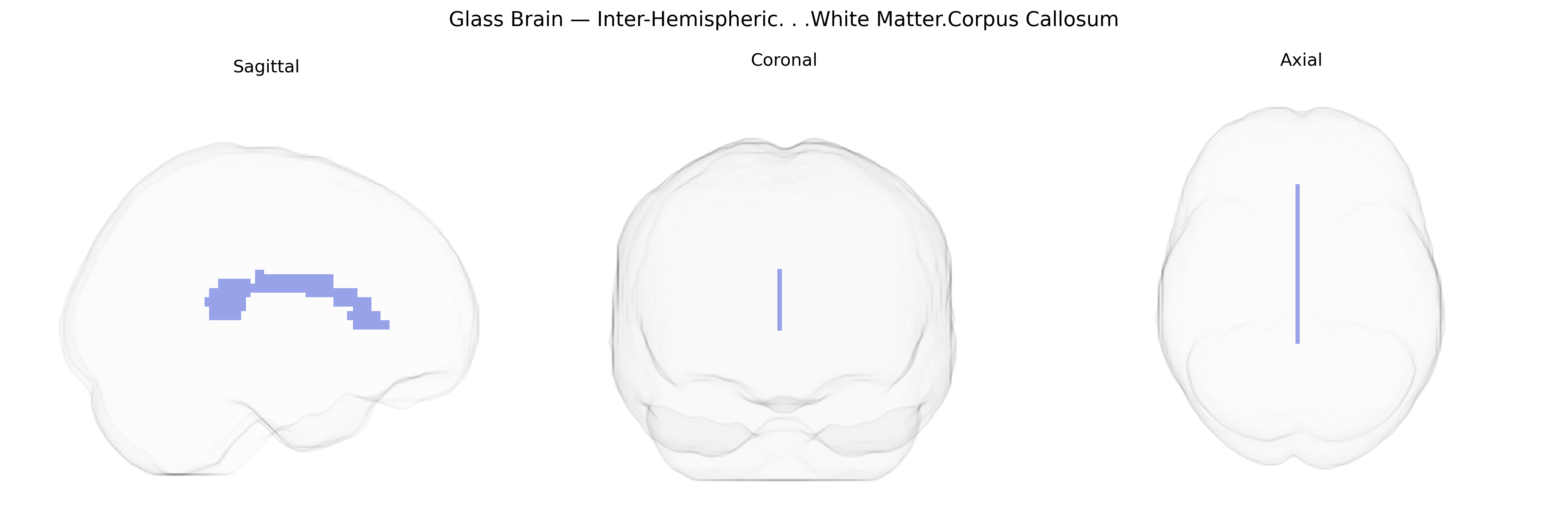 Triplanar Ghost Brain