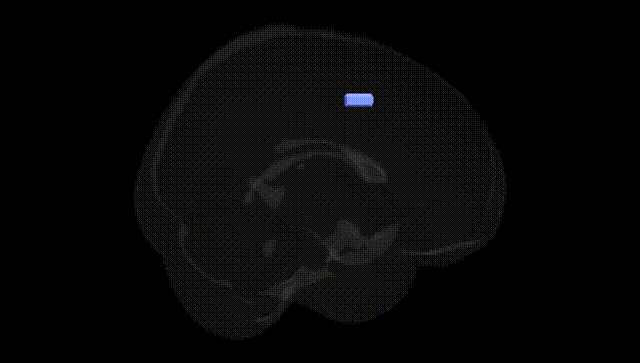 Full Brain Black