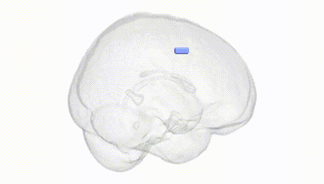Full Brain White